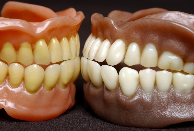 Вставная челюсть