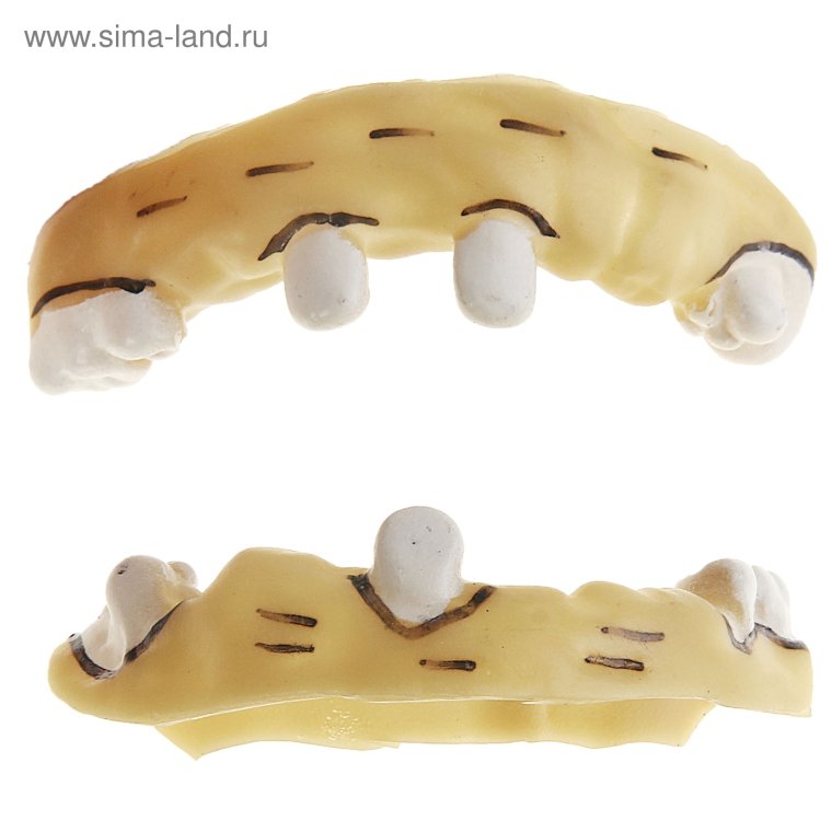 Вставная челюсть