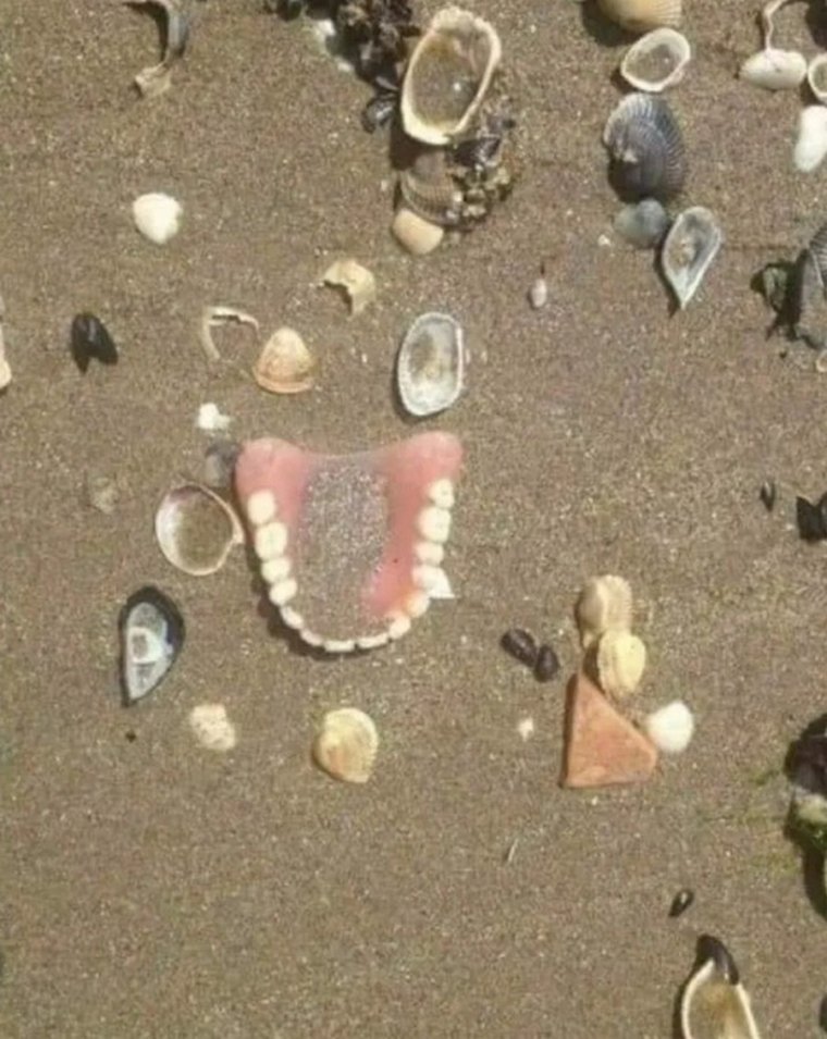 Улыбка с большими зубами