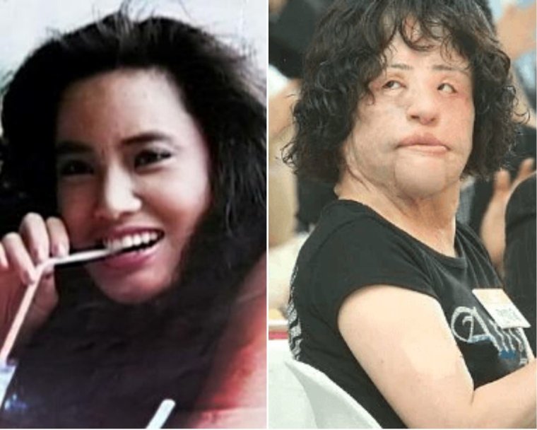 Жертва пластики Ханг Миоку