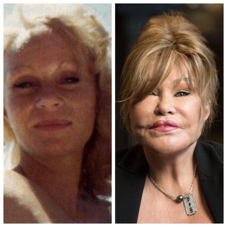 Джоселин Вильденштейн в 1985