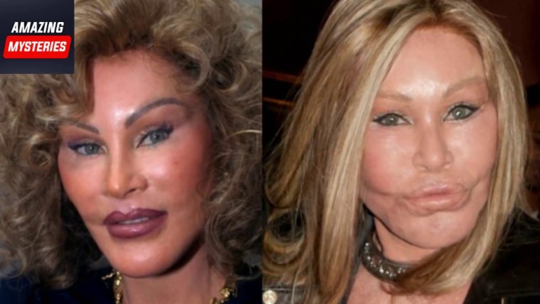 Джослин Вильденштейн в молодости