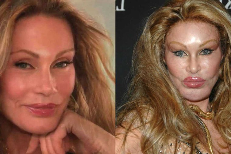 Джоселин Вильденштейн до операции Джослин