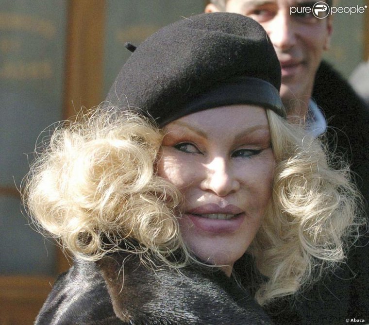 Жертва пластики Вильденштейн