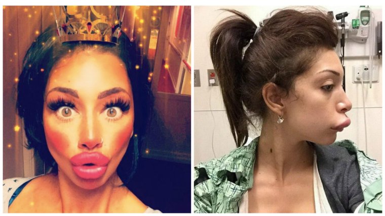 Смешное фото девушки после пластики