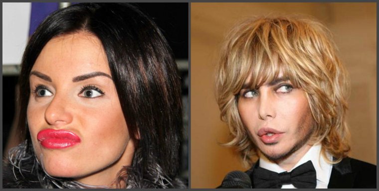 Певица с накаченными губами