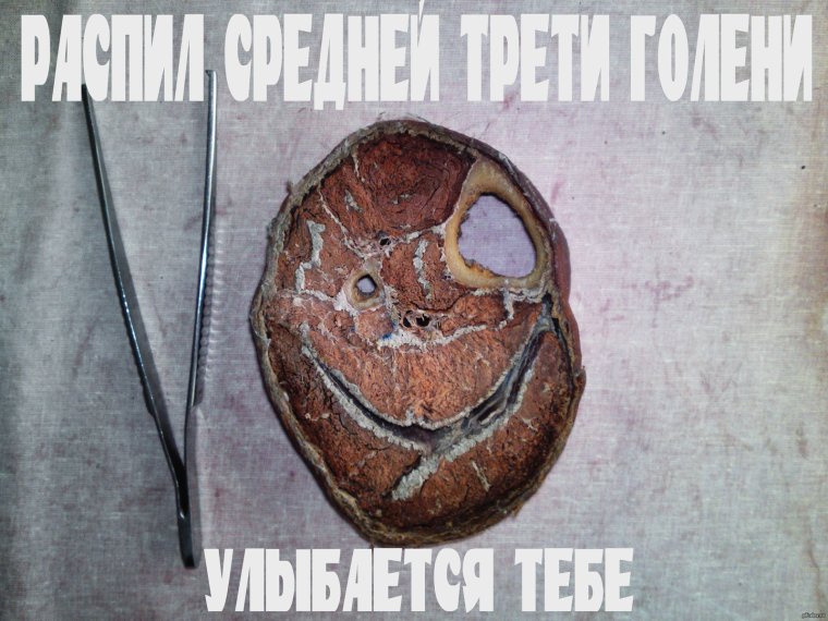 Анатомические шутки