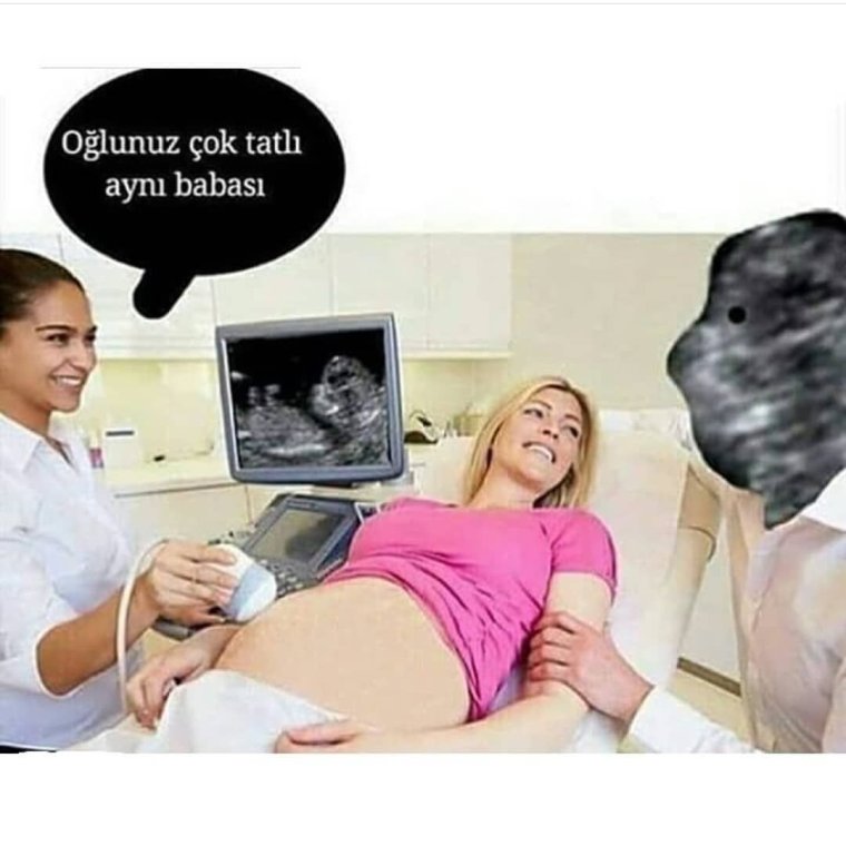 Мемы про УЗИ