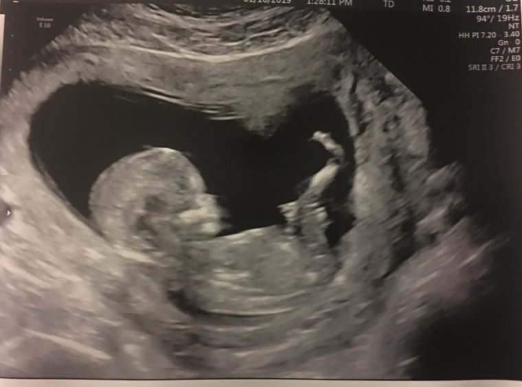 Приколы про беременность