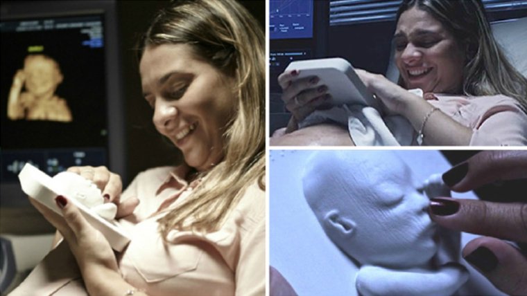 Беременные женщины УЗИ карикатуры