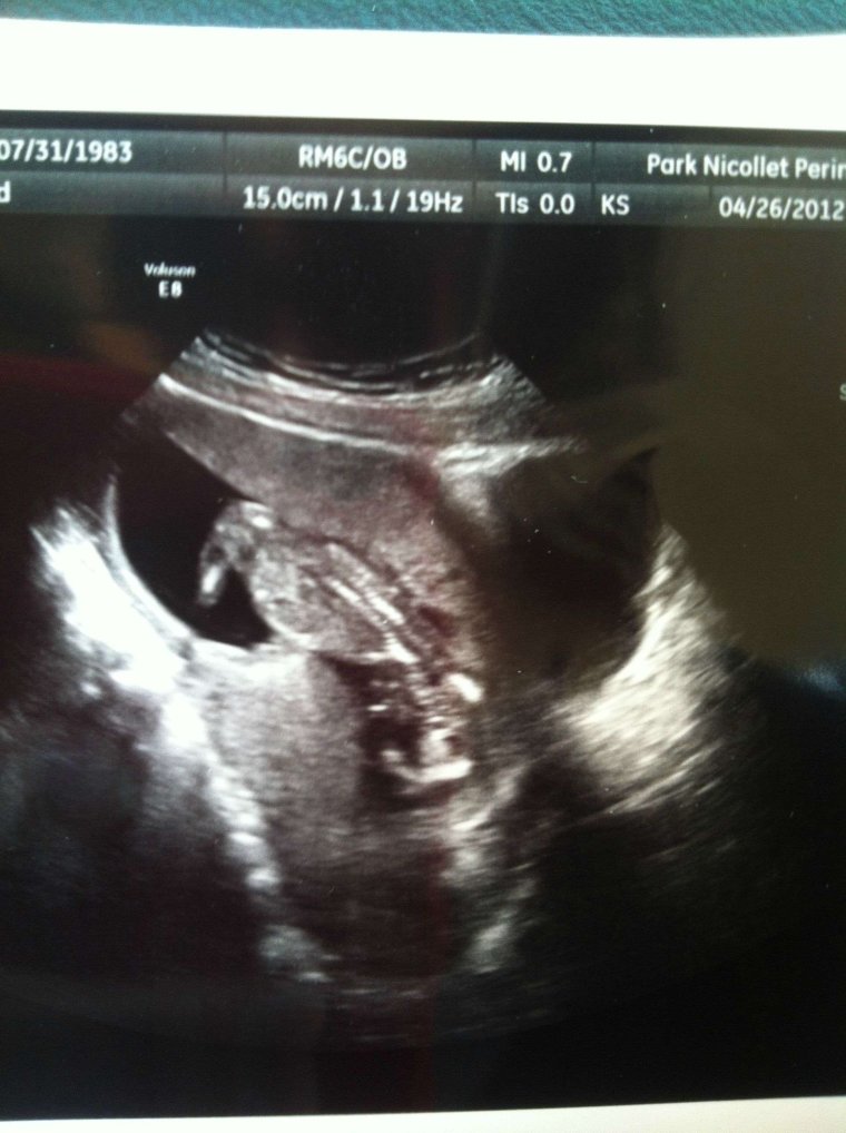 Черешнеприемник Мем