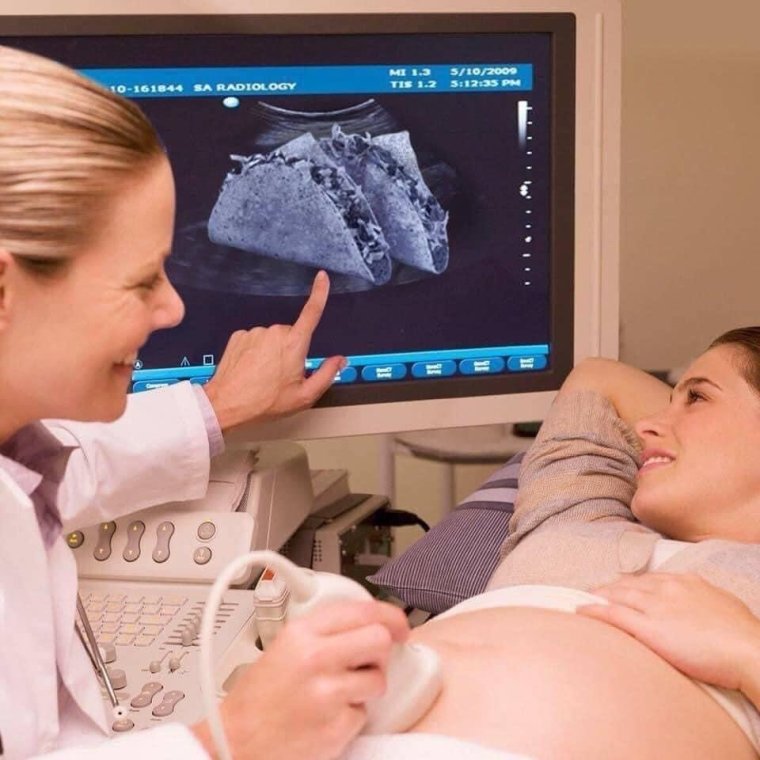 Приколы с УЗИ И беременность