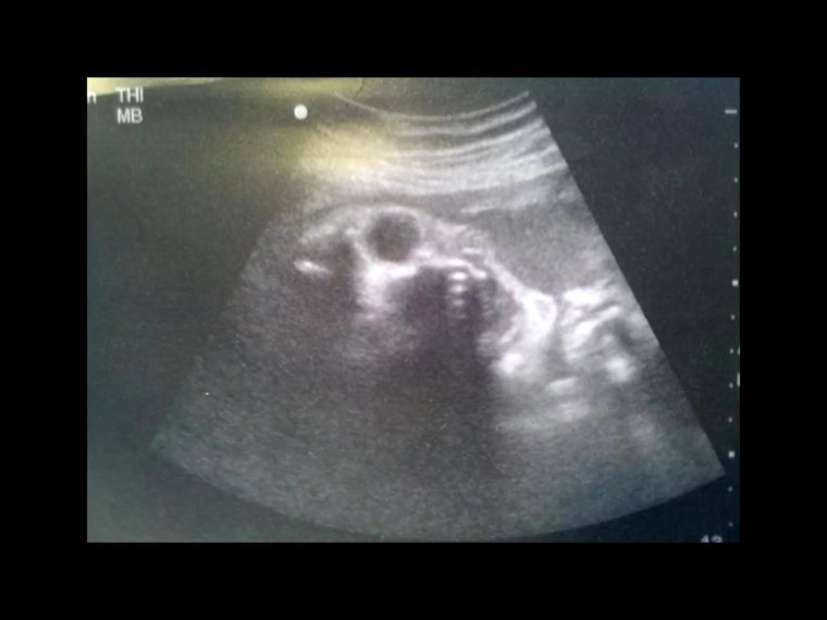 Ультразвуковая диагностика