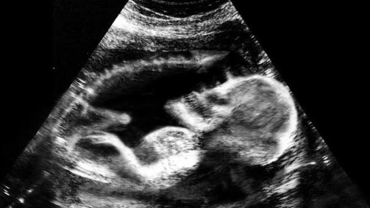 Беременная со снимком УЗИ