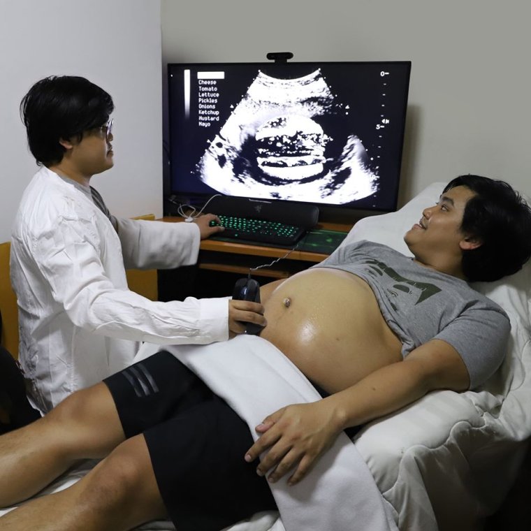 УЗИ смешные картинки