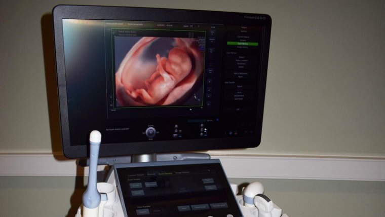 Удивительные снимки УЗИ