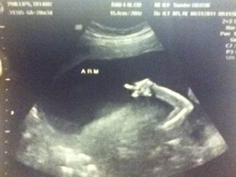 УЗИ ребенка