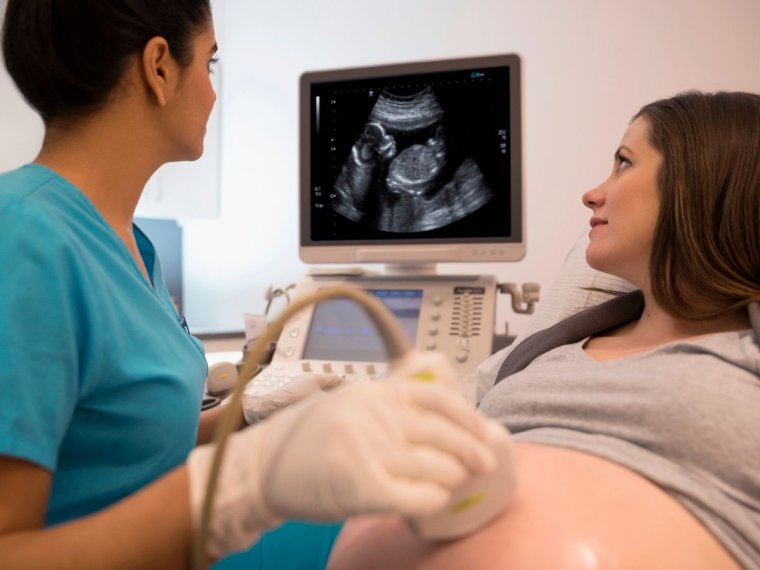 Аппарат УЗИ для беременных