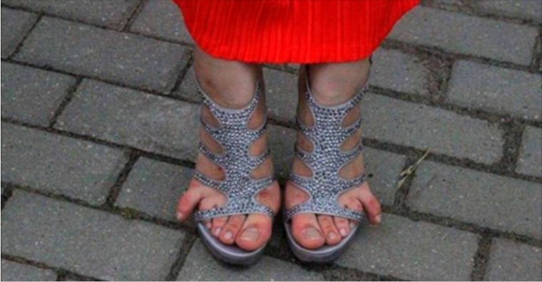 Пальцы торчат из босоножек