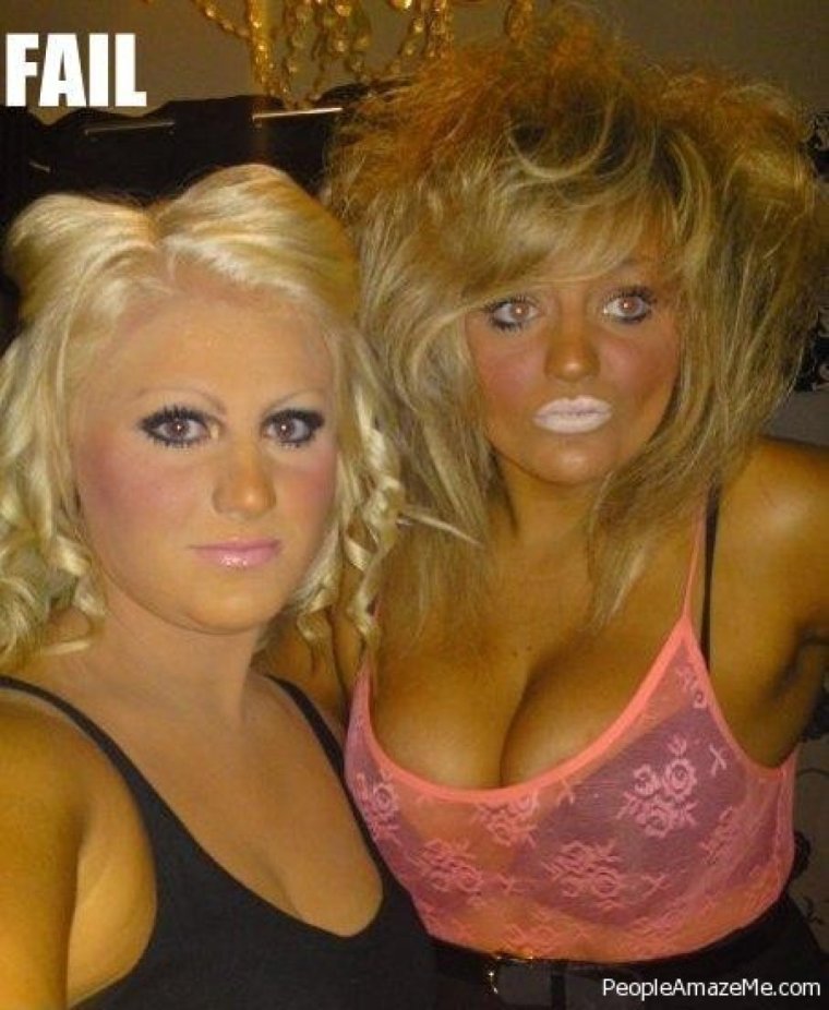 Парень обгорел на солнце