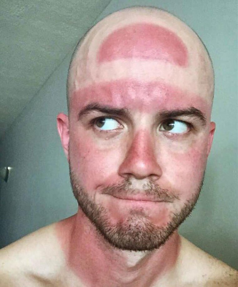 Самый Загорелый человек