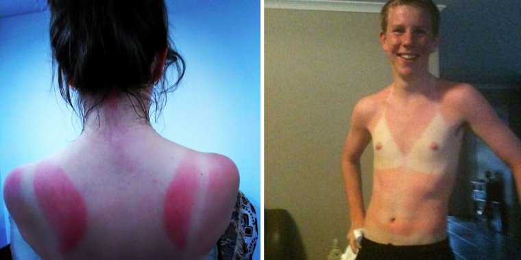 Загар шофера