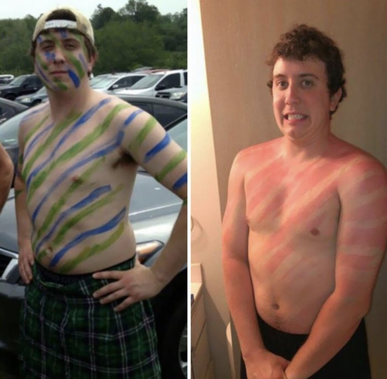 Переборщила с автозагаром