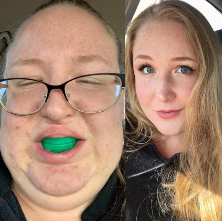 Неудачный ракурс