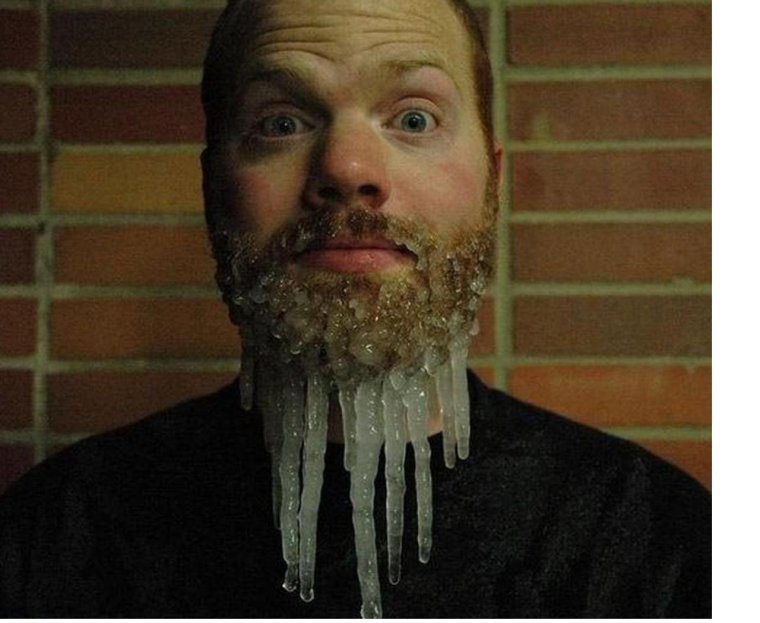 Борода с лапшой