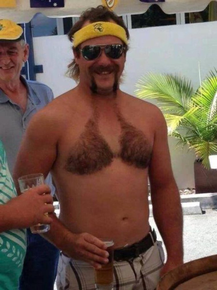 Волосы на груди