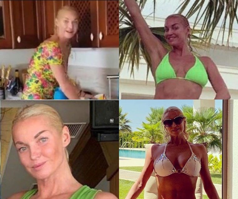 Анастасия Волочкова страшная