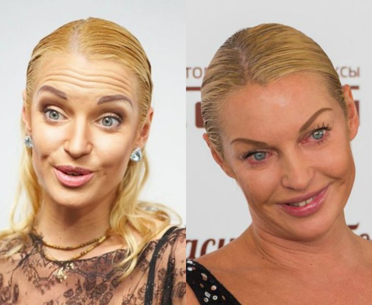 Волочкова без макияжа