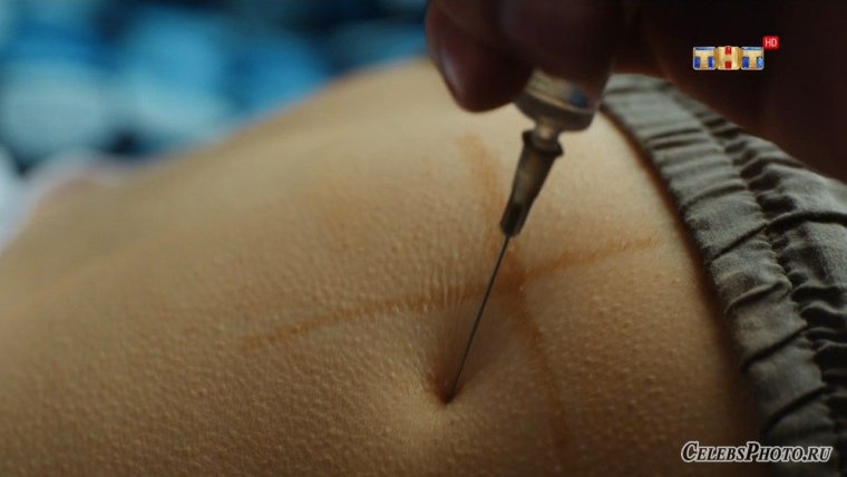 Большие уколы