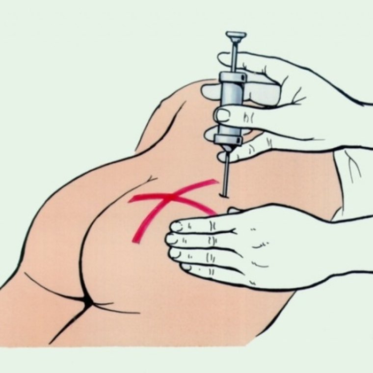 Шприцы для внутримышечных инъекций