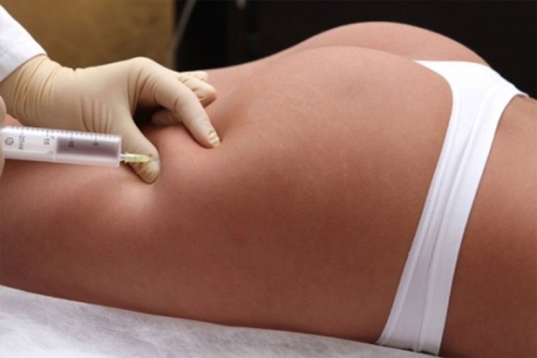 Укол в ягодицу в больнице