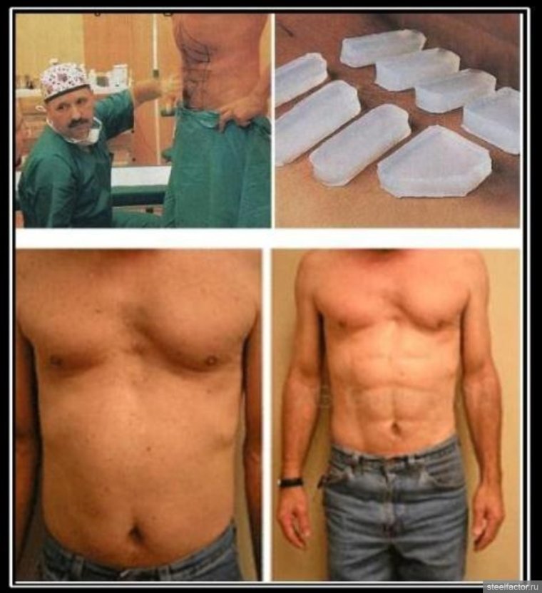 Силиконовый пресс