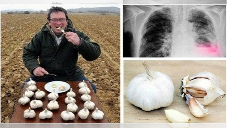 Человек чеснок