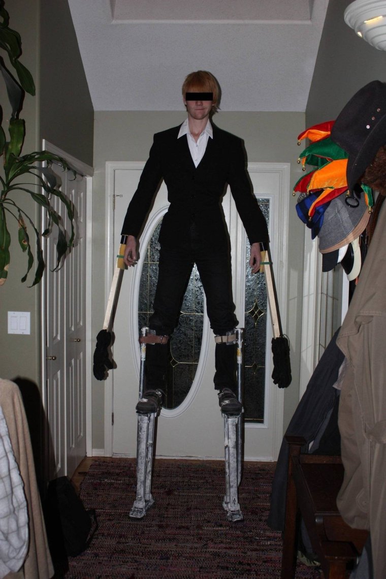 Прикольная фотосессия с поломанной ногой