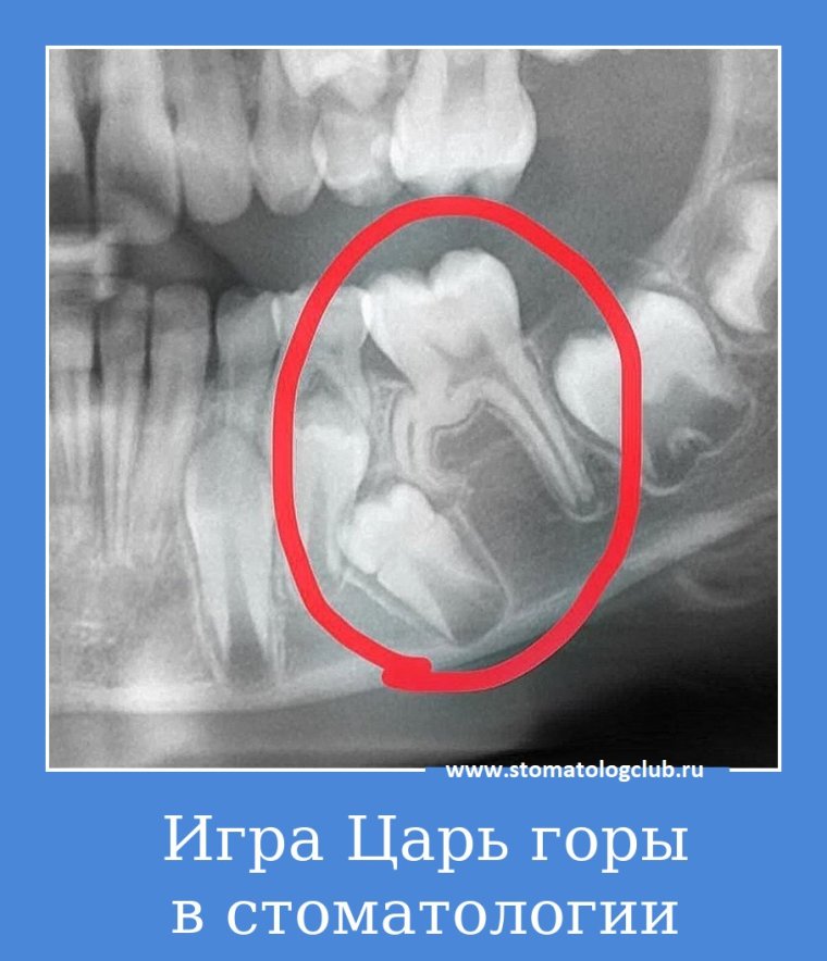 Стоматология реклама