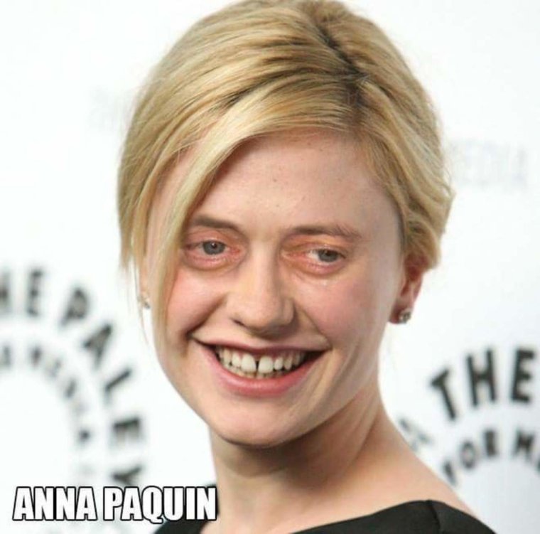 Стив Бушеми глаза