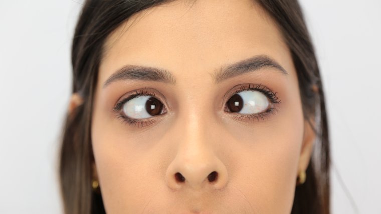 Скошенные глаза