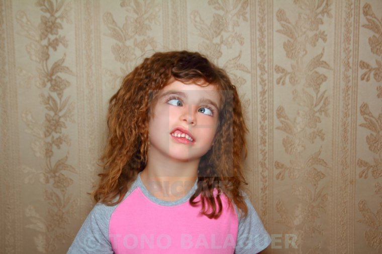 Девочка с косыми глазами