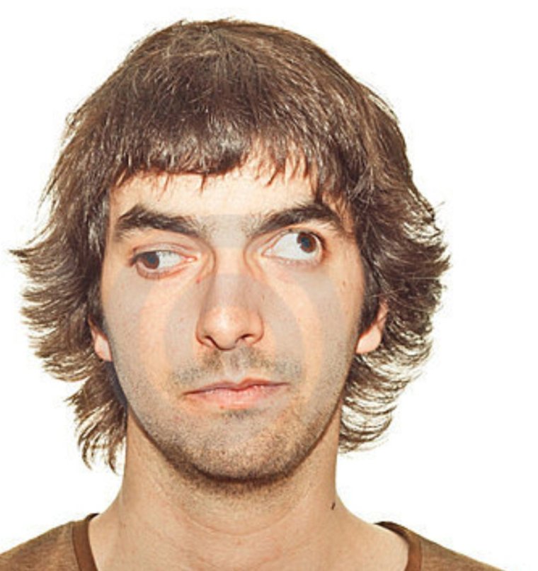 Мужик с глазами в разные стороны