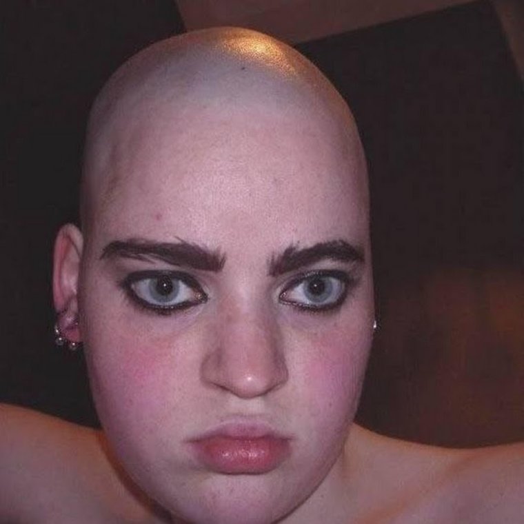 Лысые брови