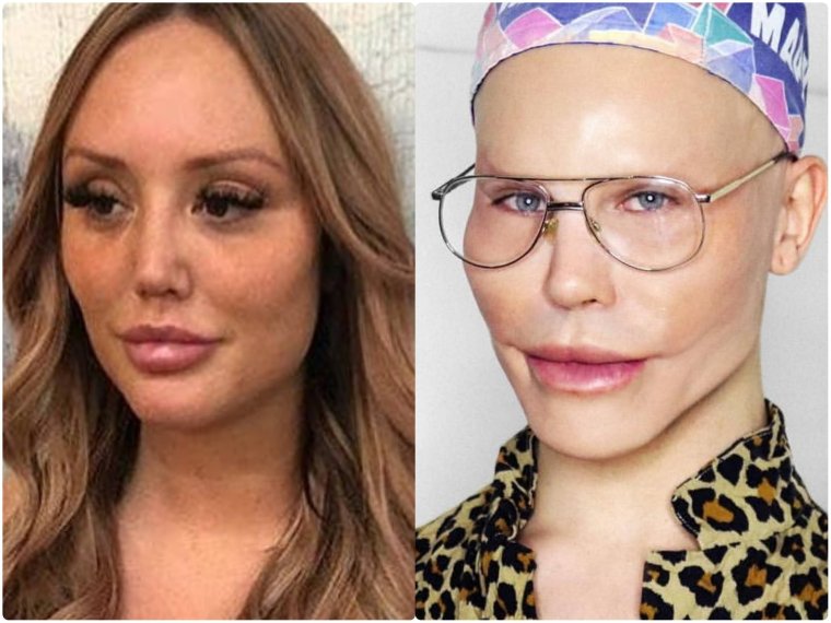 Необычные пластические операции