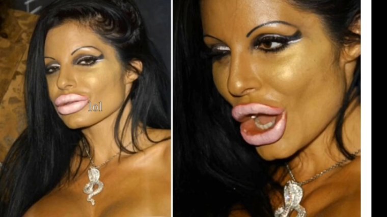 Знаменитости с накаченными губами