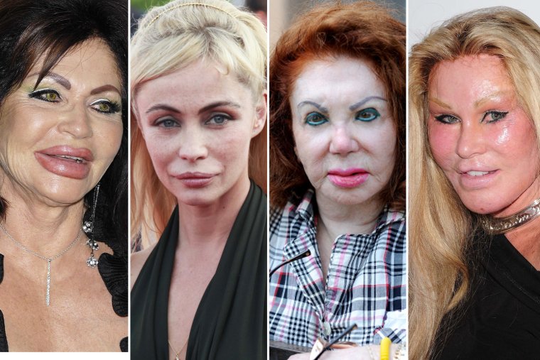 Ивон Уэлдон