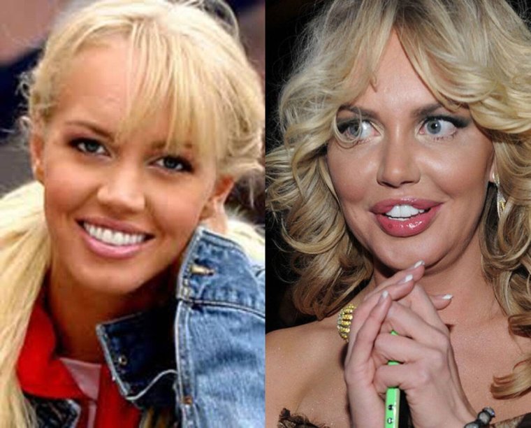 Маша Малиновская заячья губа