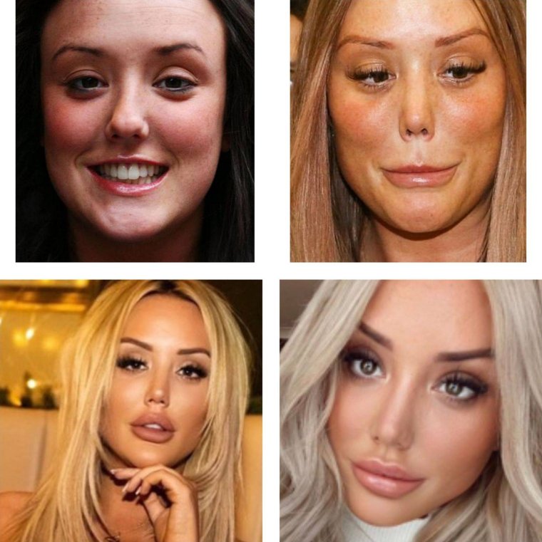 Звезды до и после операции