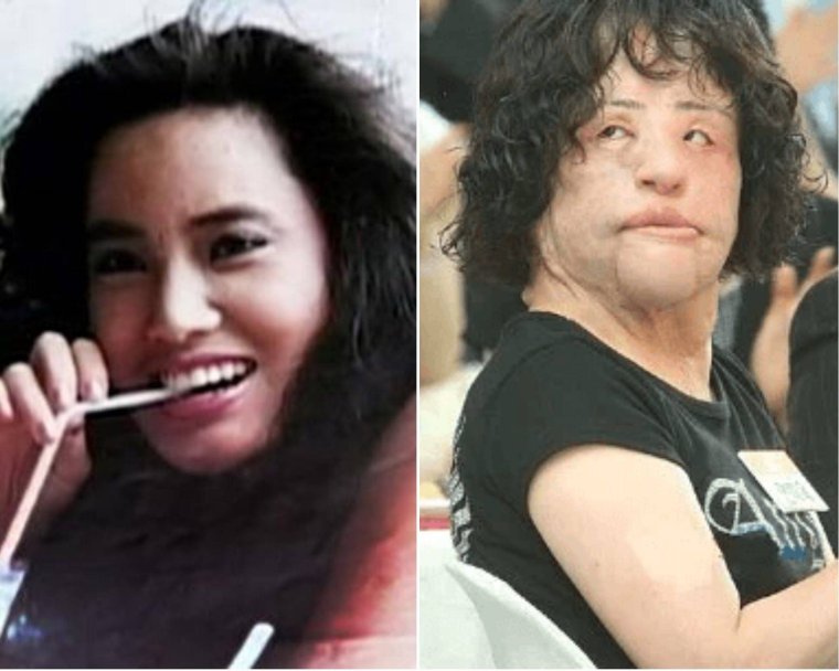 Жертва пластики Ханг Миоку